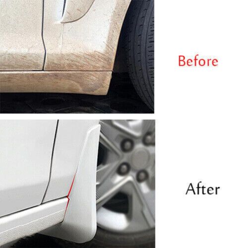 For Hyundai Elantra 2017-2020 White Car Mud Flaps Splash Guards Fender Mudguards, US $47.78, image 3
